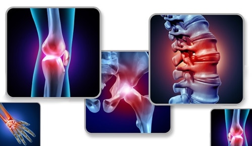 Cause and Effects: Musculoskeletal Disorders (MSDs) in Manufacturing